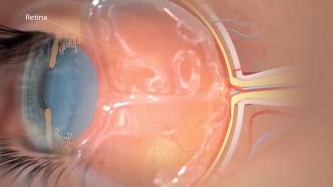 create custom medical and science animation video