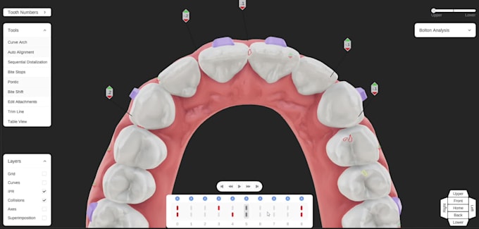 provide dental clear aligners treatment planning services
