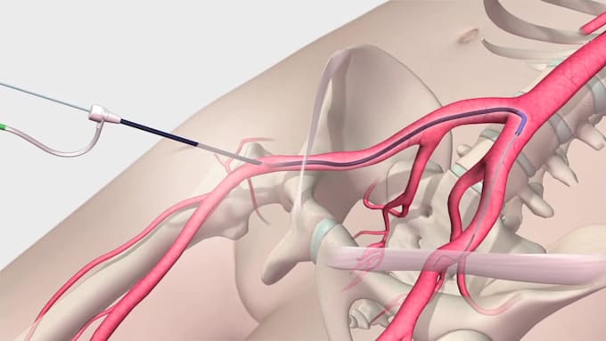 make any 3d medical animation, device animation, modeling, scienstific animation