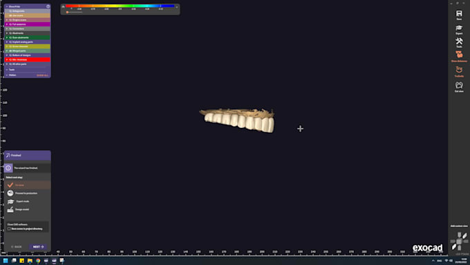 dental design with exocad