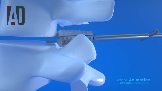 create stunning orthopedic  3d animations and renderings