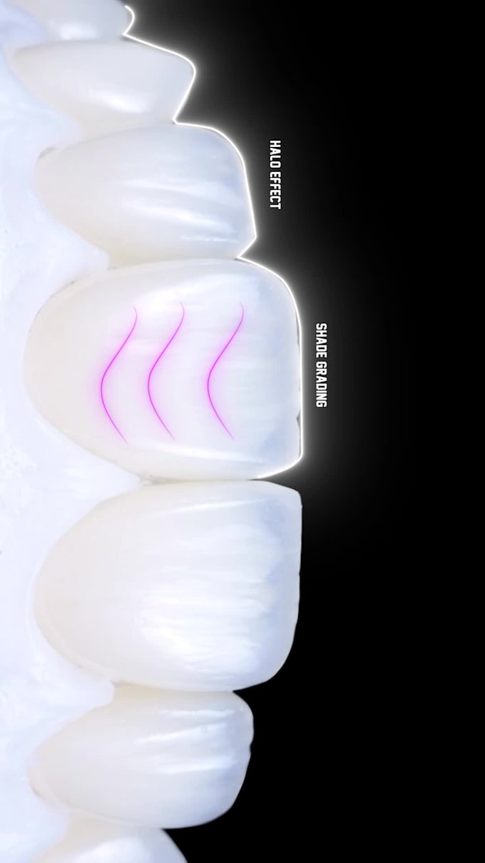 do a professional video editing on your dental cases