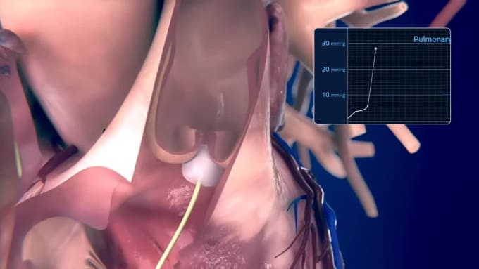 3d medical animation, medical product illustration, scientific model  animation by Digital_silk | Fiverr