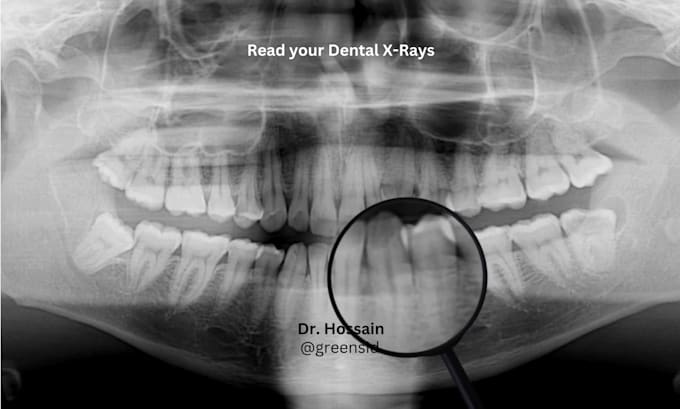 read your dental x rays