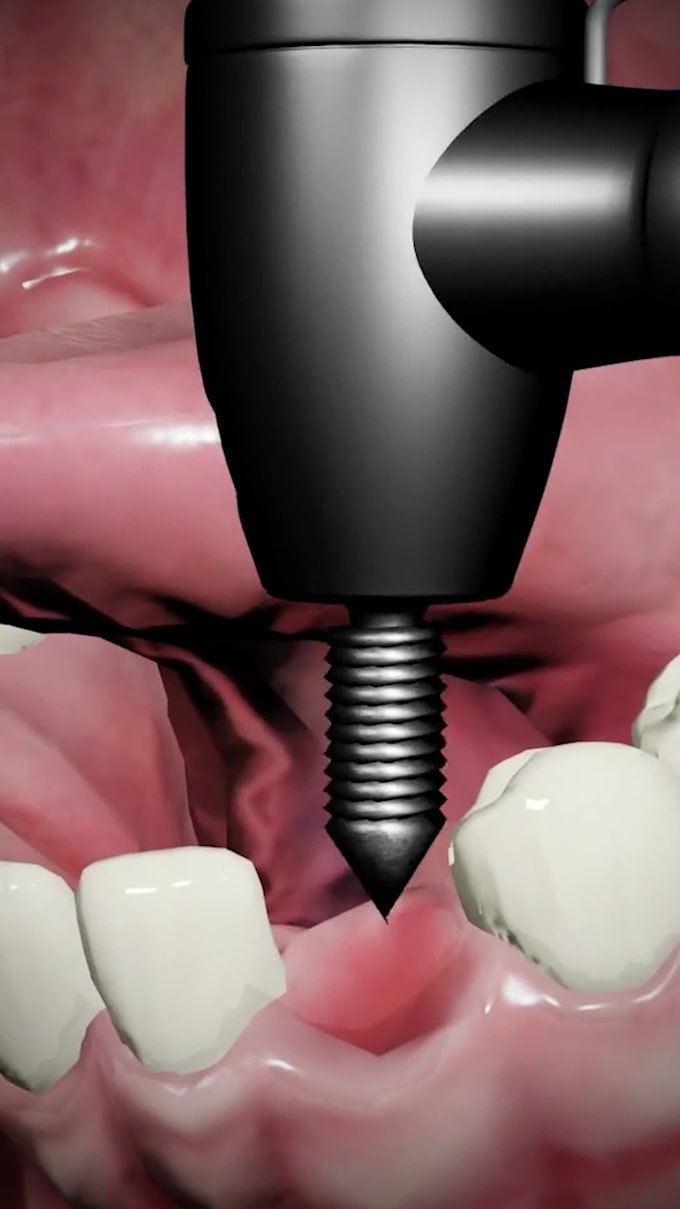 make 3d medical animated video
