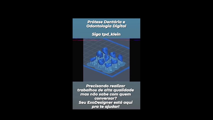 create custom crowns, bridges, or full arches using exocad