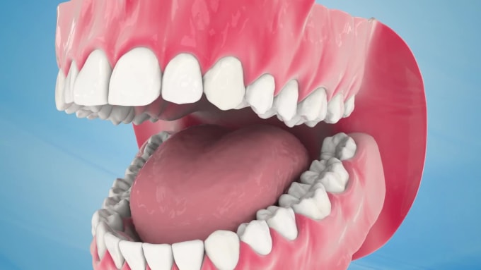 Create 3d medical animation, dental animation, dental implant, 3d ...