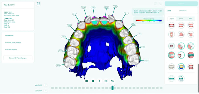 provide dental clear aligners treatment planning services