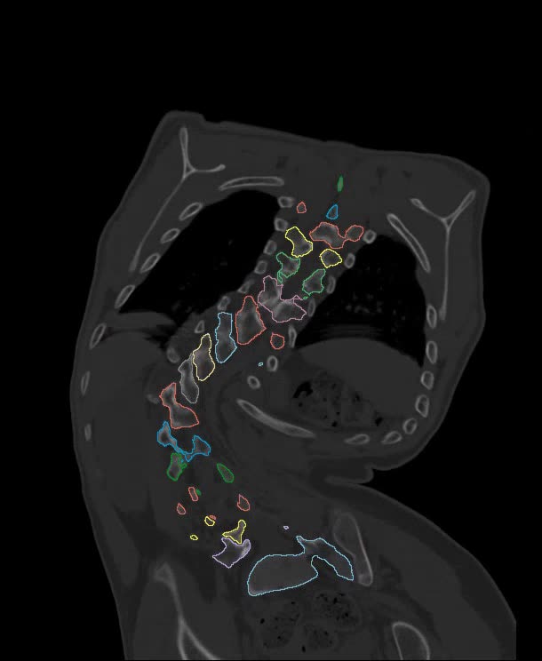 convert ct and mri images to 3d file