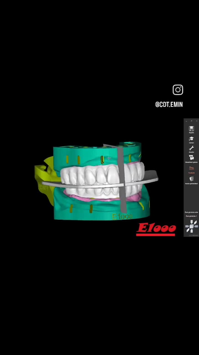 design new smiles in exocad