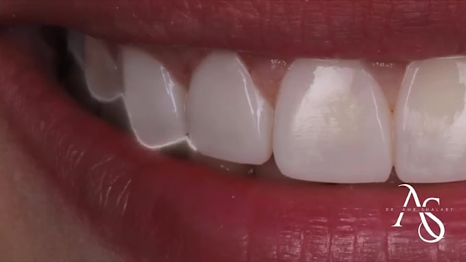 create medical video reel
