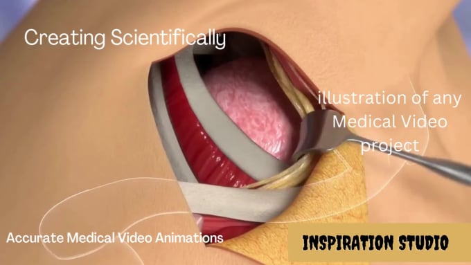 Do 3d animation medical medical animation surgery 3d medical animation by  Inspirationme | Fiverr
