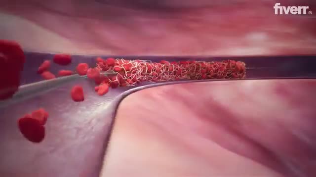 do 3d medical device animation 3d surgical device animation 3d medical explainer