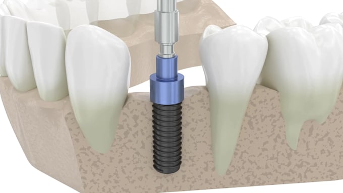 Do 3dproduct animation video , 3d product animation , 3d medical ...