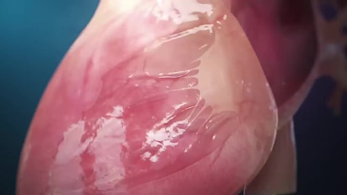 do 3d medical animation, 3d anatomy video, surgery video  and procedure