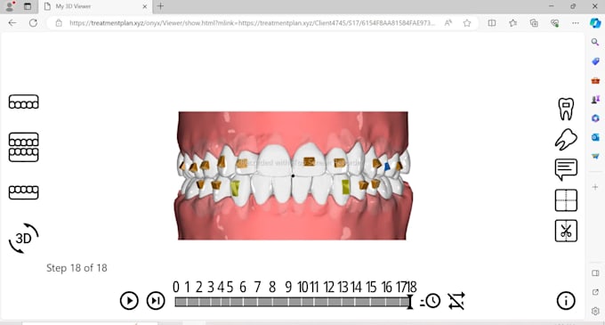 do dental clear aligner treatment planning on onyxceph