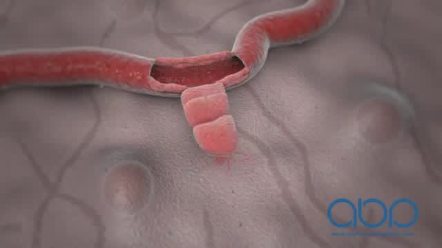 make attractive high quality 2d ,3d medical animation video and modeling