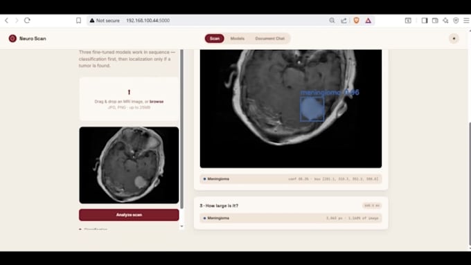 ai medical disease diagnosis, tumor detection and scan tools