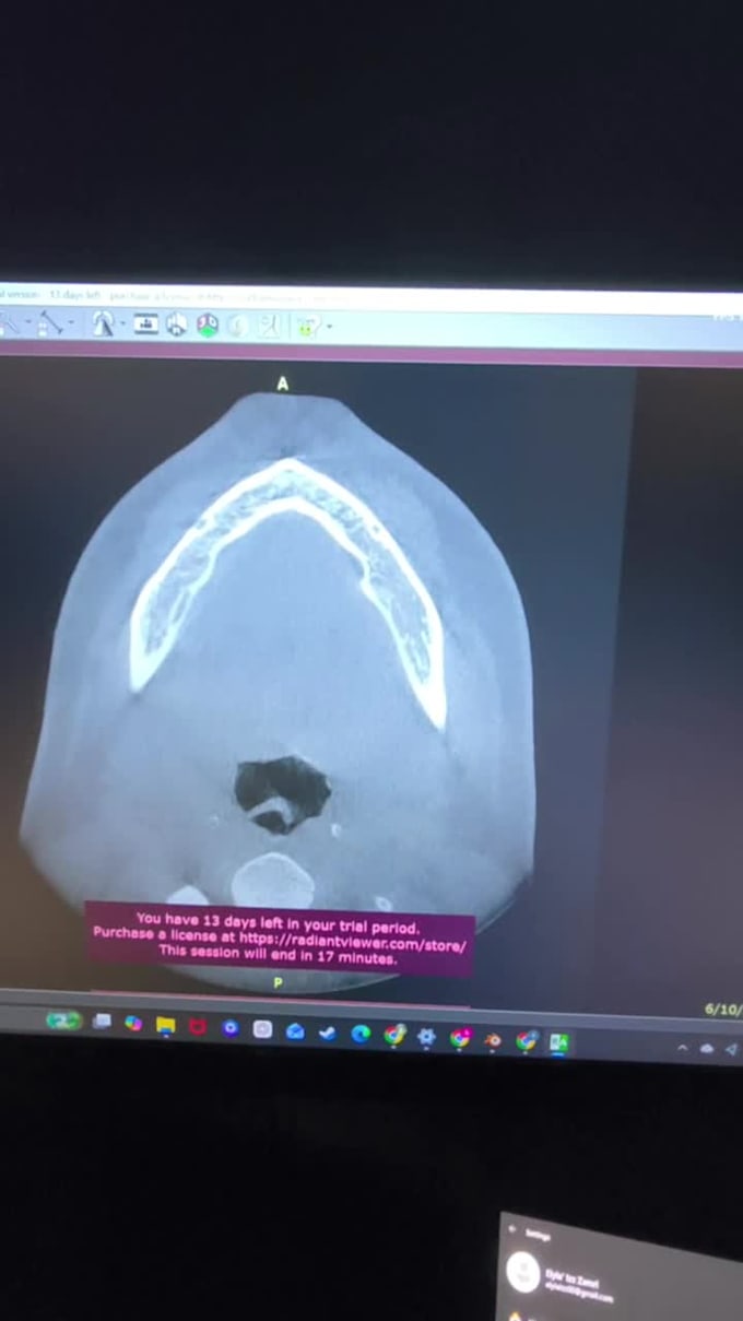 do 3d design from dicom data