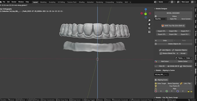 design dental crowns, bridges and implants using exocad