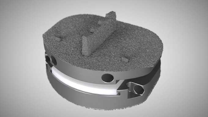 do 3d orthopedic spinal surgery animation joint replacement arthroscopy video