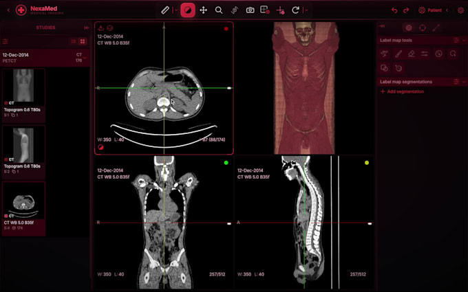 set up dicom viewer and medical imaging platform