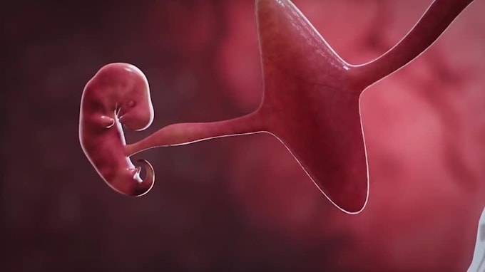 create 2d or 3d cgi animations , device surgery animation anatomy video