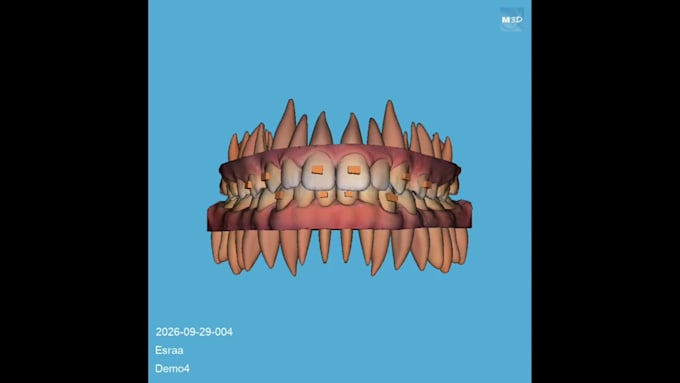 design 3d clear aligner setup and staging with maestro 3d