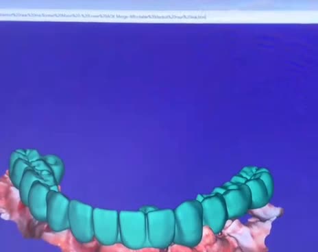 redesign your smile beautiful