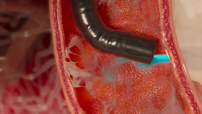 do 3d medical animation anatomy visualization biotech and pharma moa explainer