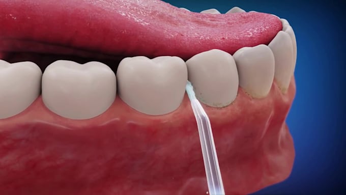 4k 3d medical surgery and device explainer animation video