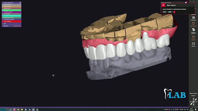 provide professional exocad dental design and 3d modeling services