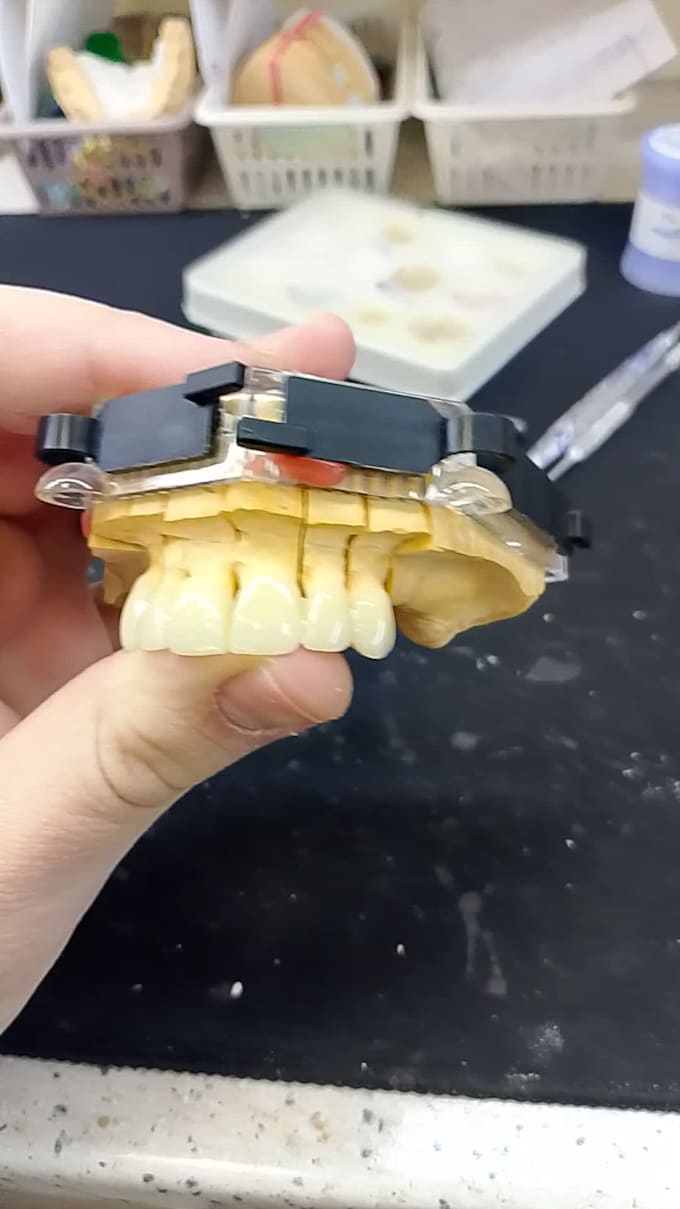 design dental prothesis all on using exocad