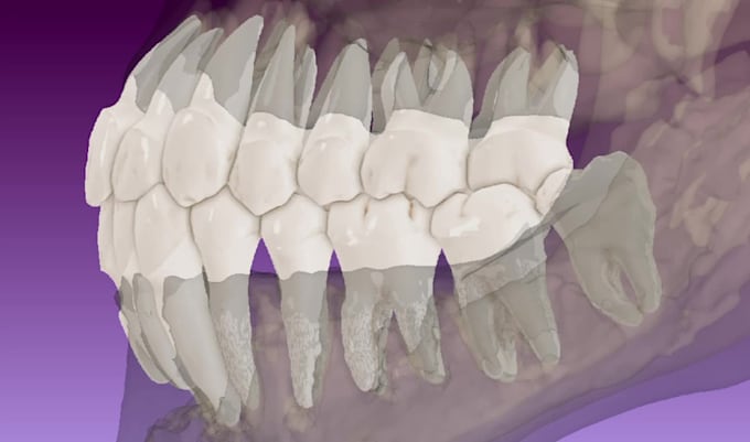 do dental cbct dicom segmentation and stl conversion