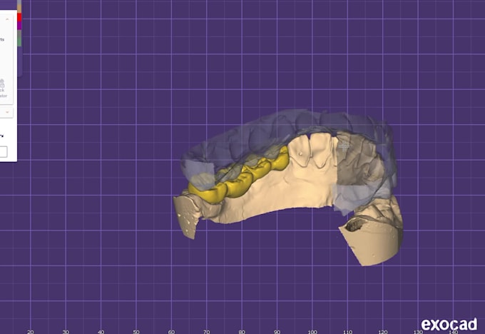 design professional dental cad cases using exocad