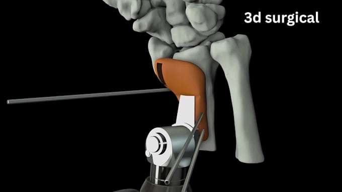 create 3d medical animation, surgical animation, surgery animation video