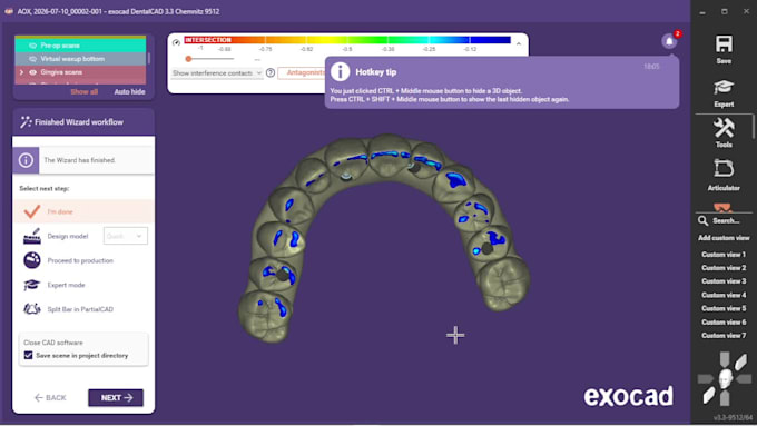 design all on x, all on 4 prosthesis using exocad