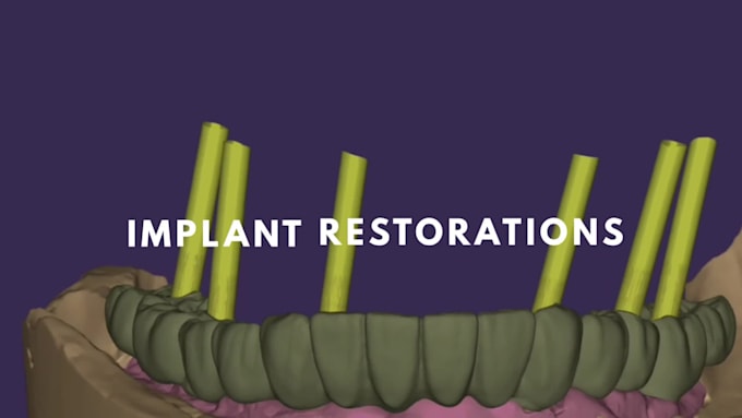 provide professional dental cad design using exocad