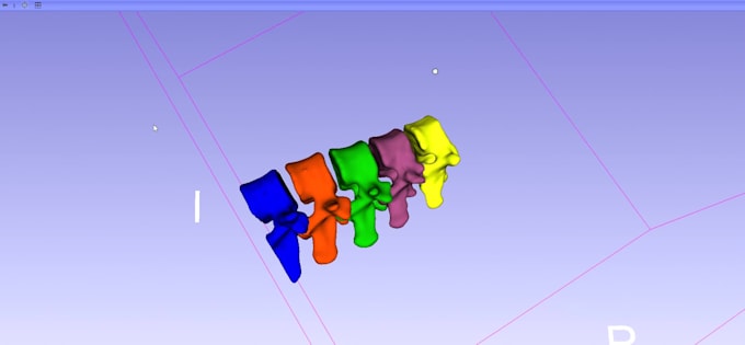 do 3d medical image segmentation and dicom conversion to stl