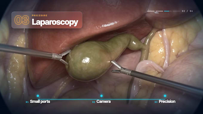 create surgical animation and medical procedure videos