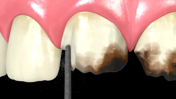 create 3d dental visuals and academic animations
