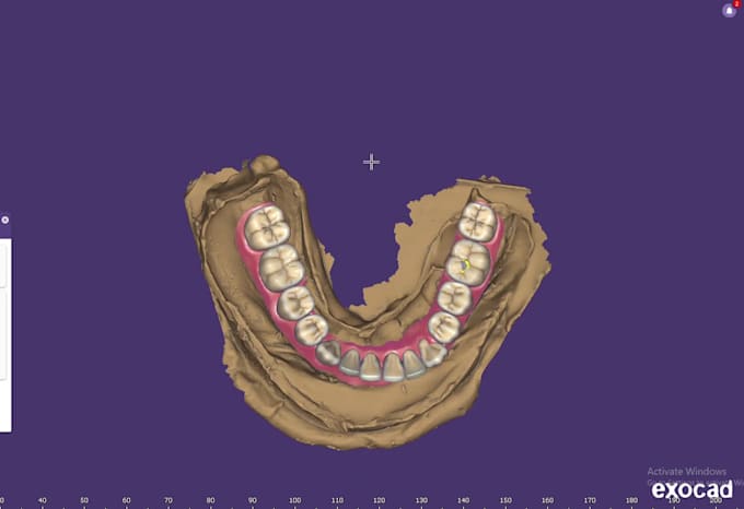 expert dental design on exocad crowns, bridge and more