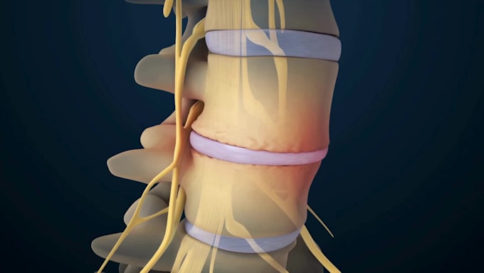create professional 3d spine surgery orthopedic and medical animation