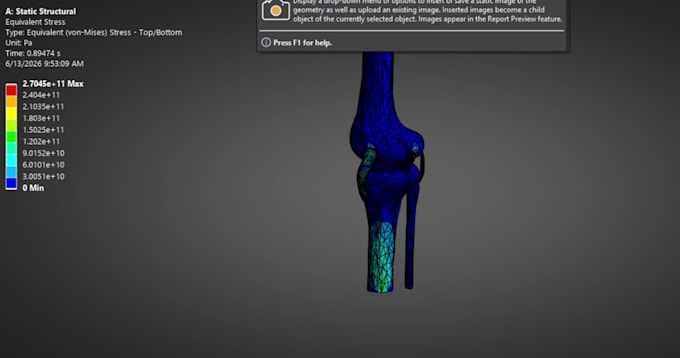 perform stress analysis and biomechanical behavior in ansys