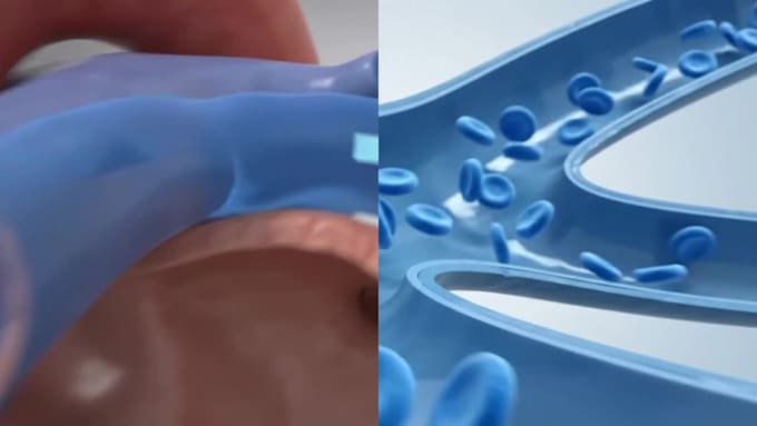 create a professional 3d medical animation, surgery, anatomy animation video