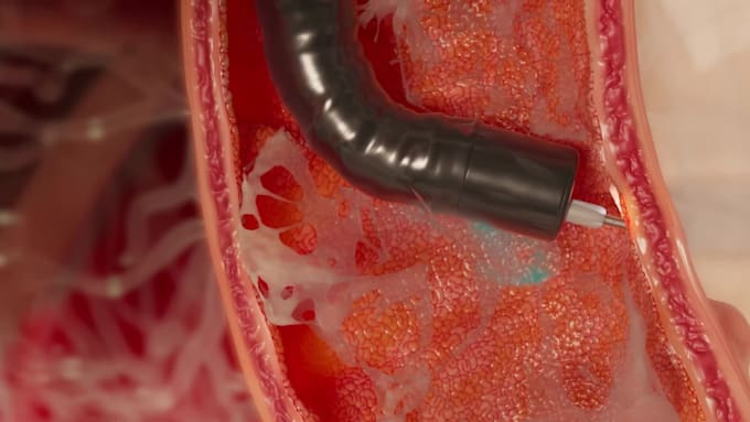 create professional 3d medical and surgical animation video