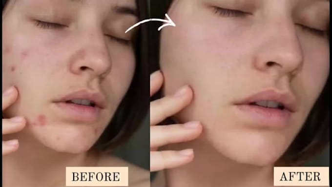 professionally retouch and edit skin