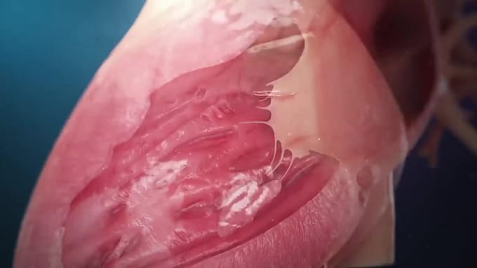 create a professional 3d medical animation video