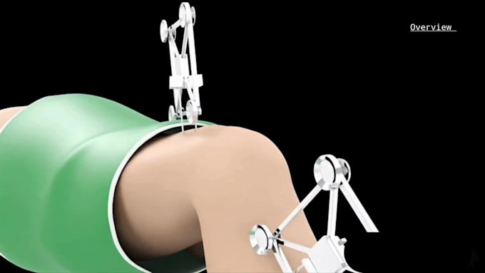 create 3d medical animation, 3d surgery animation, orthopedic knee replacement