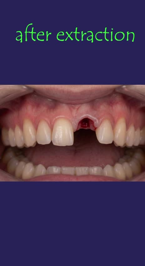 create professional dental animations and 3d dental motion graphics